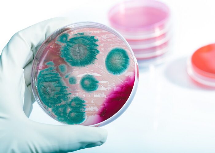 listeria-principal