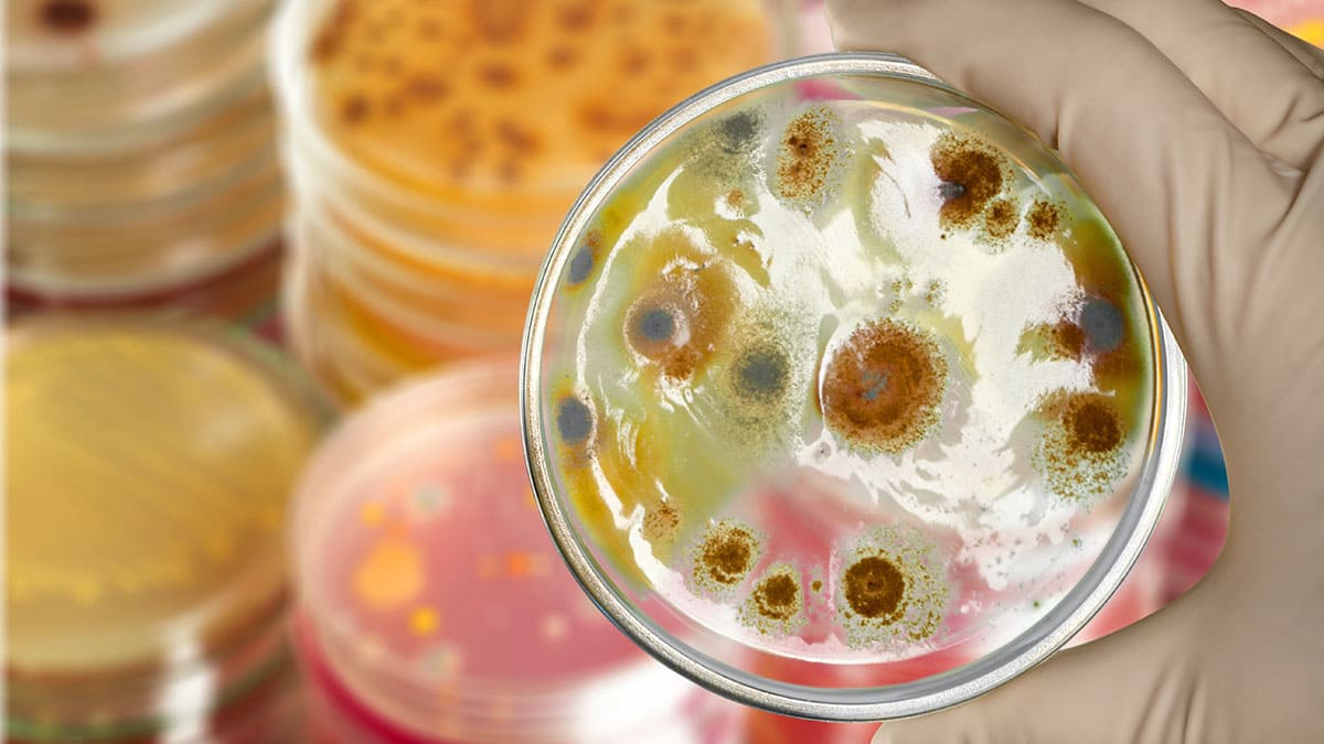 Kit detecta patógenos en alimentos a bajo costo y en poco tiempo