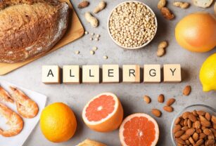 alergenos-alimentarios