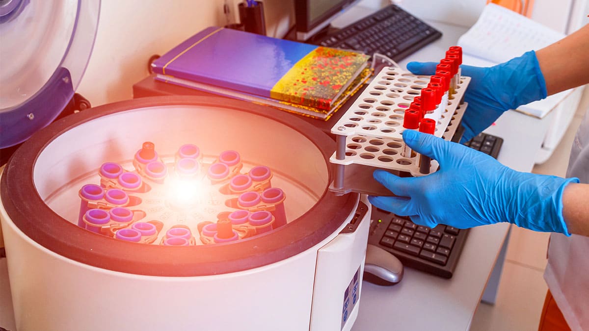 Beneficios de la luz pulsada en la industria de alimentos