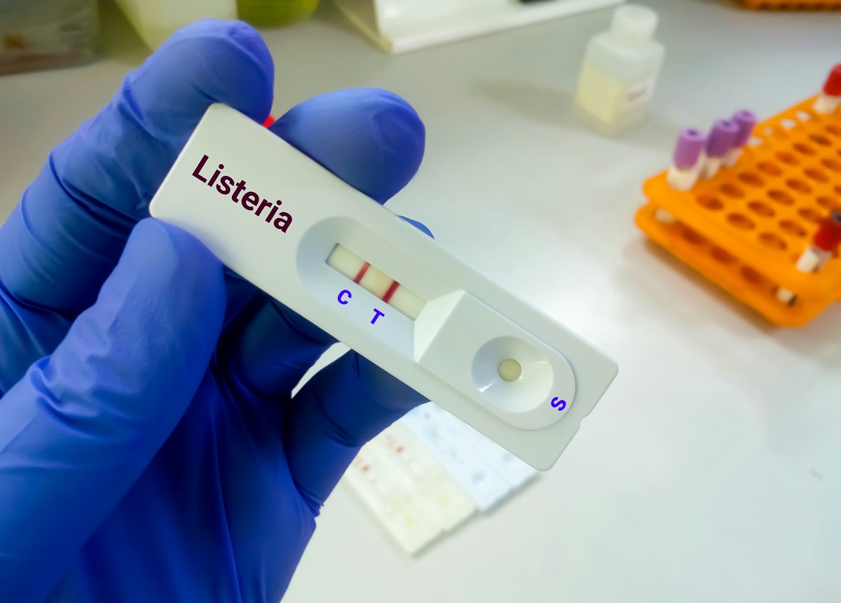 Diferenciación de la Listeria monocytogenes en alimentos mediante espectroscopia FT-IR